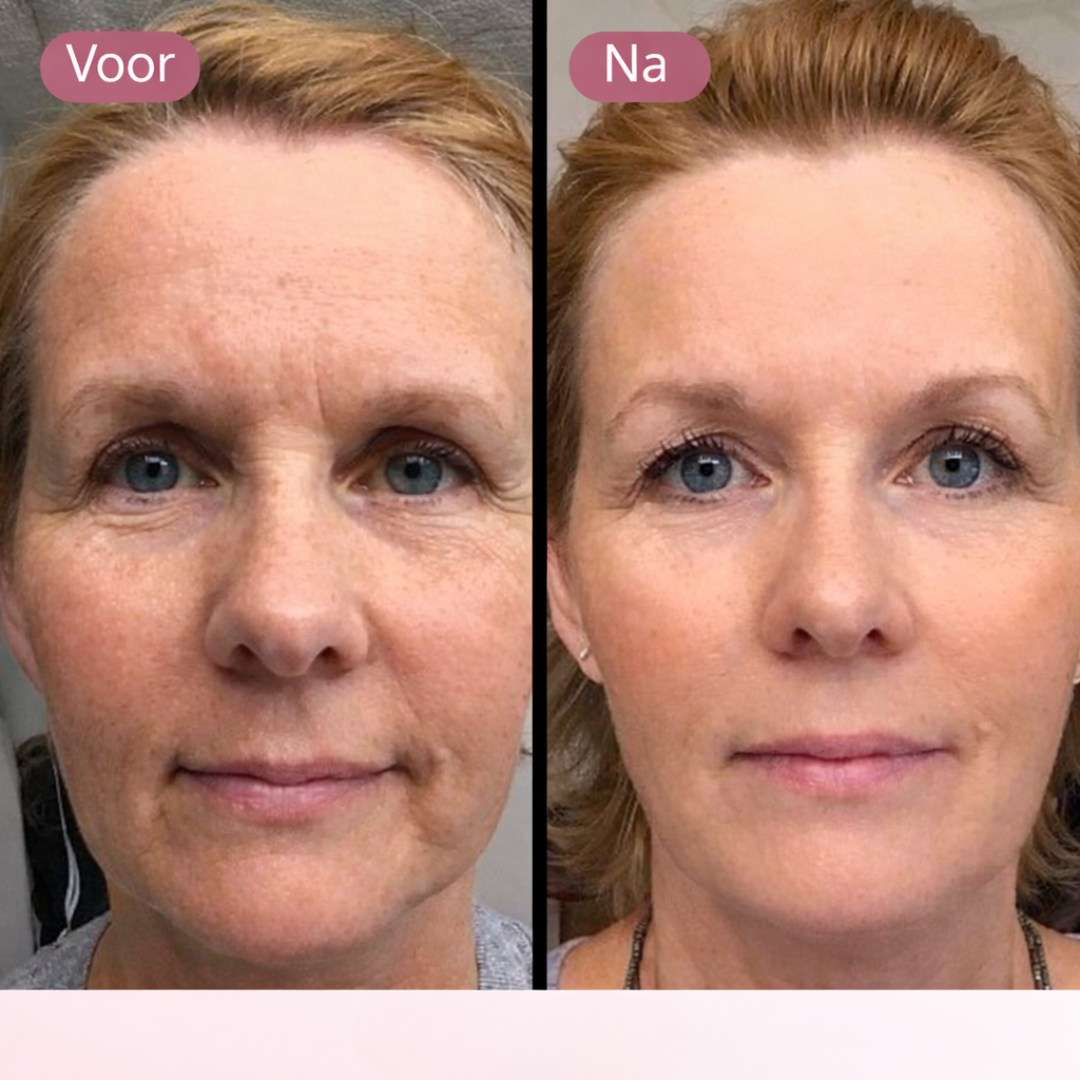 Jade Gezicht Roller &amp; Gua Sha Steen